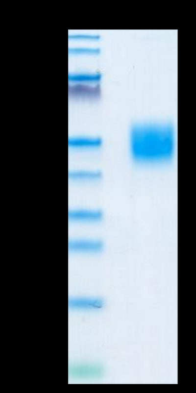 Mouse CD200 on Tris-Bis PAGE under reduced condition. The purity is greater than 95%.Recombinant Mouse CD200/OX-2 Protein, Active