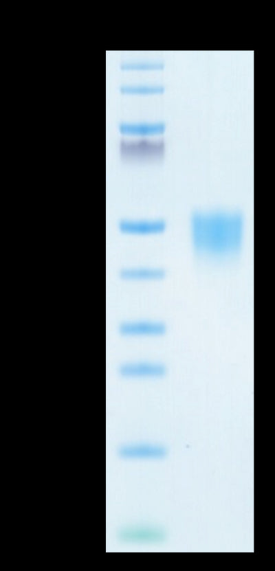 Human CD200 on Tris-Bis PAGE under reduced condition. The purity is greater than 95%.Recombinant Human CD200/OX-2 Protein, Active