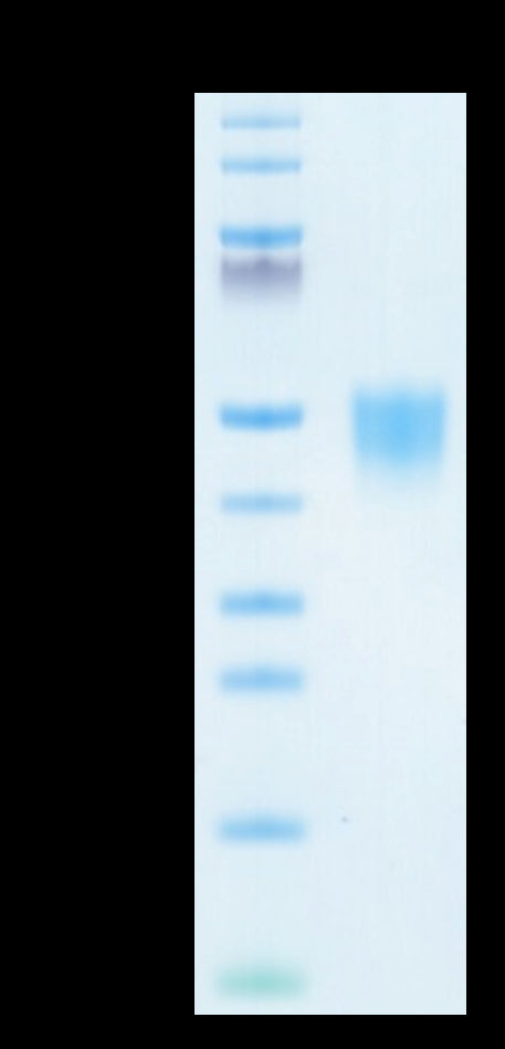 Human CD200 on Tris-Bis PAGE under reduced condition. The purity is greater than 95%.Recombinant Human CD200/OX-2 Protein, Active
