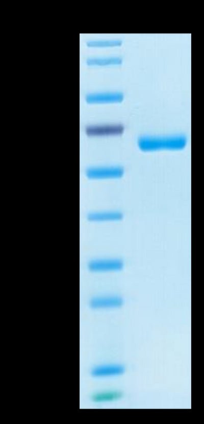 Human CD2 on Tris-Bis PAGE under reduced condition. The purity is greater than 95%.Recombinant Human CD2/SRBC Protein