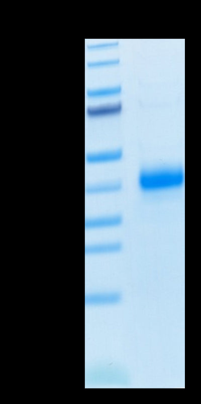 Human CD2 on Tris-Bis PAGE under reduced condition. The purity is greater than 95%.Recombinant Human CD2/SRBC Protein, Active