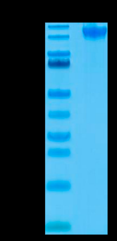 Human Semaphorin 4D on Tris-Bis PAGE under reduced condition. The purity is greater than 95%.Recombinant Human Semaphorin 4D/SEMA4D/CD100 Protein, Active