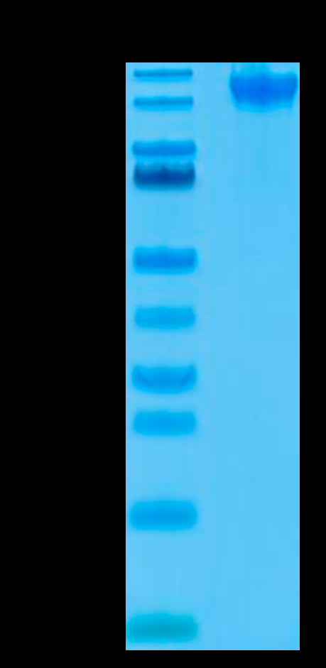 Human Semaphorin 4D on Tris-Bis PAGE under reduced condition. The purity is greater than 95%.Recombinant Human Semaphorin 4D/SEMA4D/CD100 Protein, Active