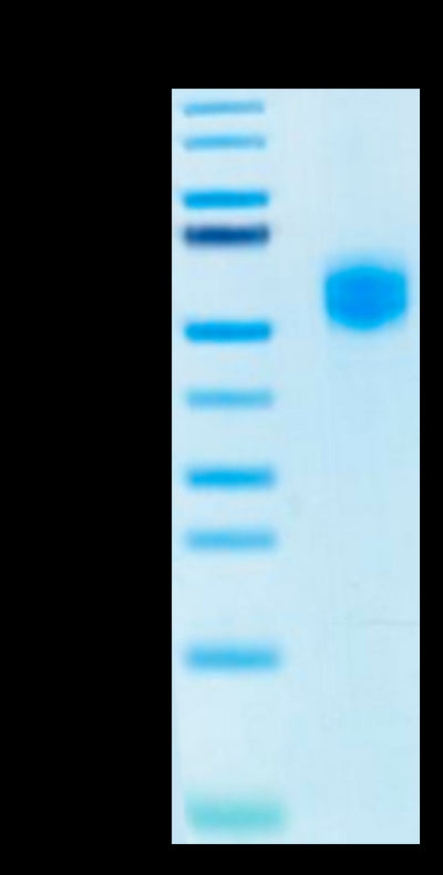 Human SIRP alpha V2 on Tris-Bis PAGE under reduced condition. The purity is greater than 95%.Recombinant Human SIRP alpha V2/CD172a Protein, Active