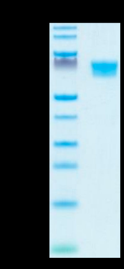 Human AXL on Tris-Bis PAGE under reduced condition. The purity is greater than 95%.Recombinant Human AXL Protein, Active
