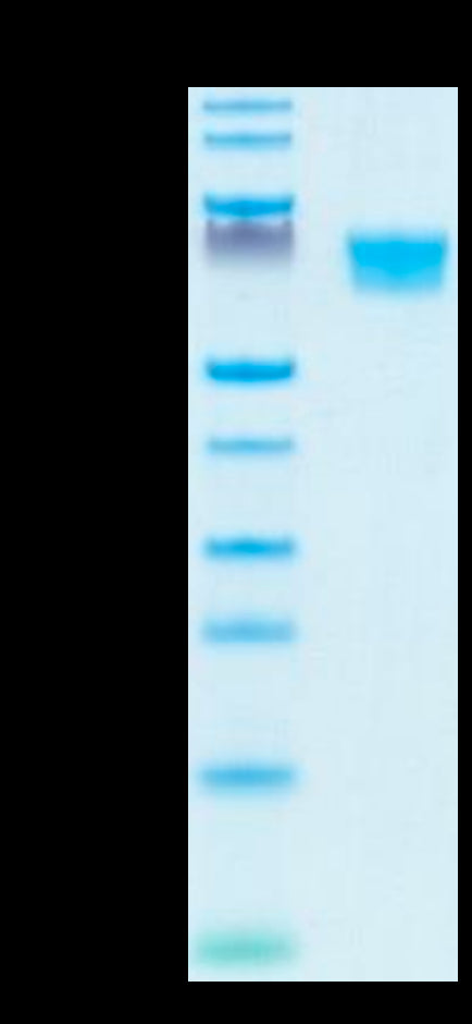 Human AXL on Tris-Bis PAGE under reduced condition. The purity is greater than 95%.Recombinant Human AXL Protein, Active