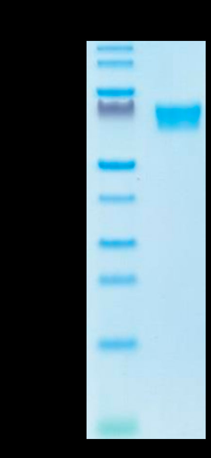 Biotinylated Human AXL on Tris-Bis PAGE under reduced condition. The purity is greater than 95%.Biotinylated Human AXL Protein, Active