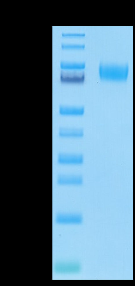 Human B7-H3 (4Ig) on Tris-Bis PAGE under reduced condition. The purity is greater than 95%.Recombinant Human B7-H3 (4Ig) /B7-H3b Protein, Active