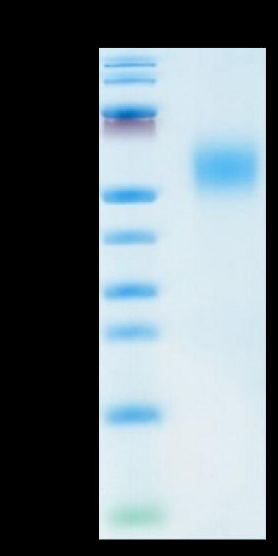 Human FGFR2 beta (IIIb) on Tris-Bis PAGE under reduced condition. The purity is greater than 95%.Recombinant Human FGFR2 beta (IIIb) Protein, Active