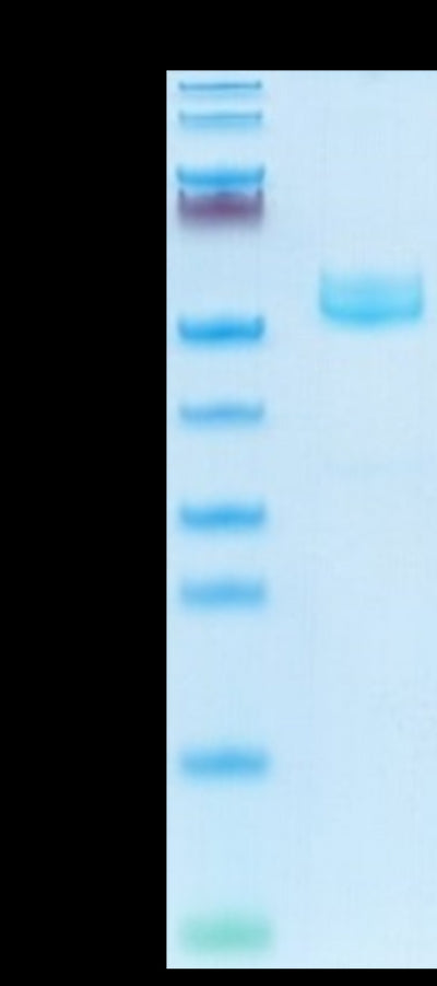 Mouse CD7 on Tris-Bis PAGE under reduced condition. The purity is greater than 95%.Recombinant Mouse CD7 Protein
