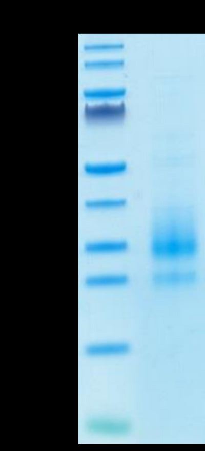 Cynomolgus NKG2C/CD159c on Tris-Bis PAGE under reduced conditions. The purity is greater than 95%.Recombinant Cynomolgus NKG2C/CD159c Protein