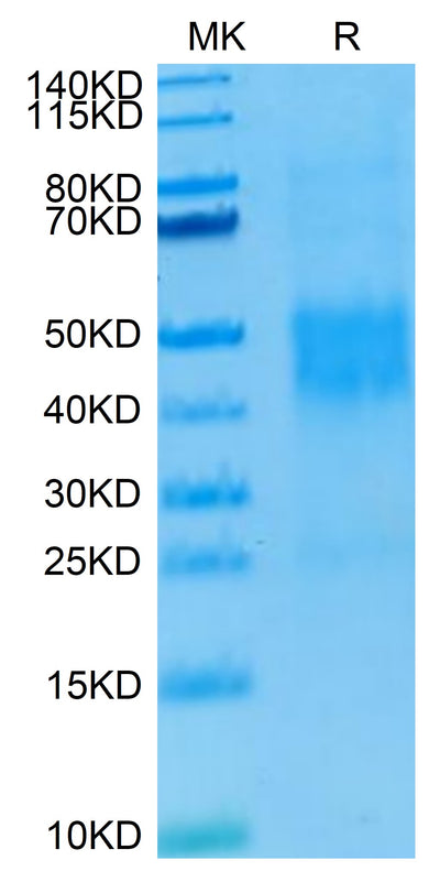 Human NKG2C/CD159c on Tris-Bis PAGE under reduced condition. The purity is greater than 95%.Recombinant Human NKG2C/CD159c Protein