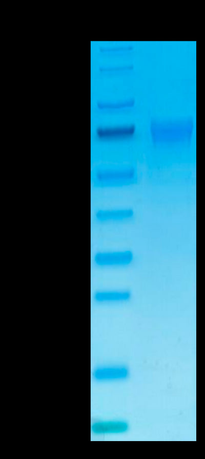 Human NKp46 on Tris-Bis PAGE under reduced condition. The purity is greater than 95%.Recombinant Human NKp46/NCR1/CD335 Protein, Active