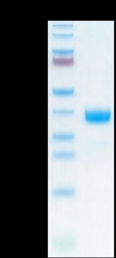Cynomolgus NKp46 on Tris-Bis PAGE under reduced condition. The purity is greater than 95%.Recombinant Cynomolgus NKp46/NCR1/CD335 Protein, Active