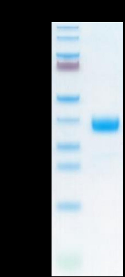 Cynomolgus NKp46 on Tris-Bis PAGE under reduced condition. The purity is greater than 95%.Recombinant Cynomolgus NKp46/NCR1/CD335 Protein, Active