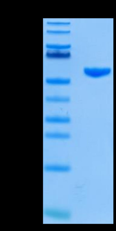 Human HLA-A*02:01&B2M&GP100 (YLEPGPVTA) Monomer on Tris-Bis PAGE under reduced condition. The purity is greater than 95%.Recombinant Human HLA-A*02:01&B2M&GP100 (YLEPGPVTA) Monomer Protein, Active