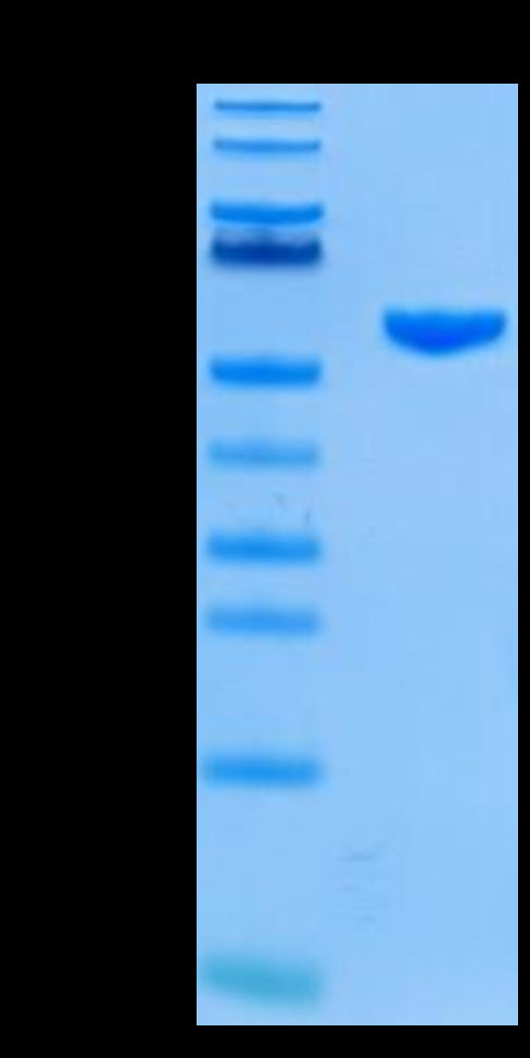 Human HLA-A*02:01&B2M&GP100 (YLEPGPVTA) Monomer on Tris-Bis PAGE under reduced condition. The purity is greater than 95%.Recombinant Human HLA-A*02:01&B2M&GP100 (YLEPGPVTA) Monomer Protein, Active