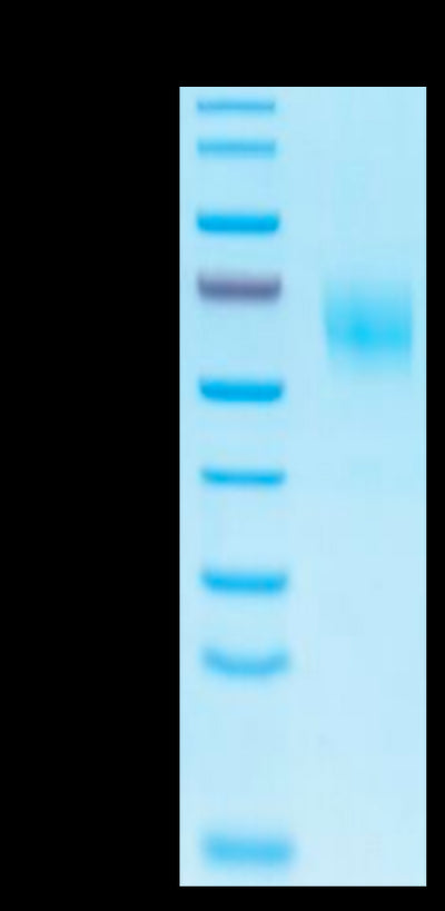 Biotinylated Human IL-1 Rrp2 on Tris-Bis PAGE under reduced condition. The purity is greater than 95%.Biotinylated Human IL-1 Rrp2/IL-1 R6 Protein, Active