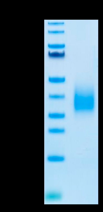 Biotinylated Human TREM2 on Tris-Bis PAGE under reduced condition. The purity is greater than 95%.Biotinylated Human TREM2 Protein, Active