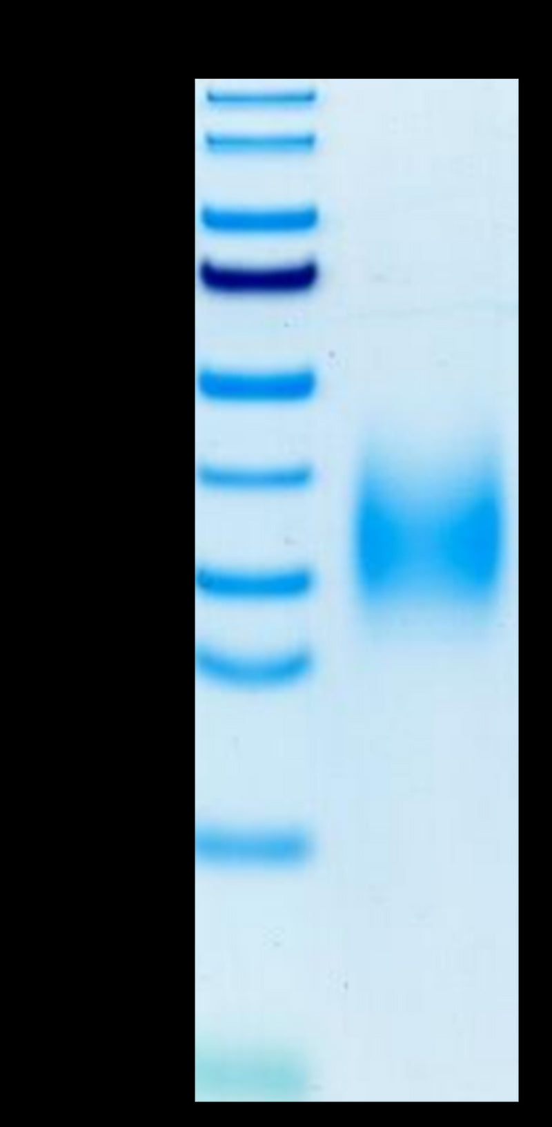 Human TREM2 on Tris-Bis PAGE under reduced condition. The purity is greater than 95%.Recombinant Human TREM2 Protein, Active