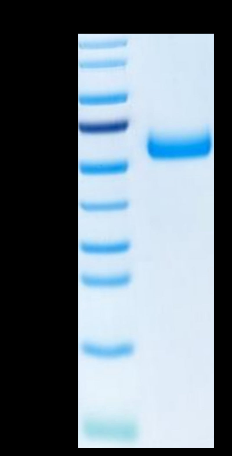Human TREM2 on Tris-Bis PAGE under reduced condition. The purity is greater than 95%.Recombinant Human TREM2 Protein, Active