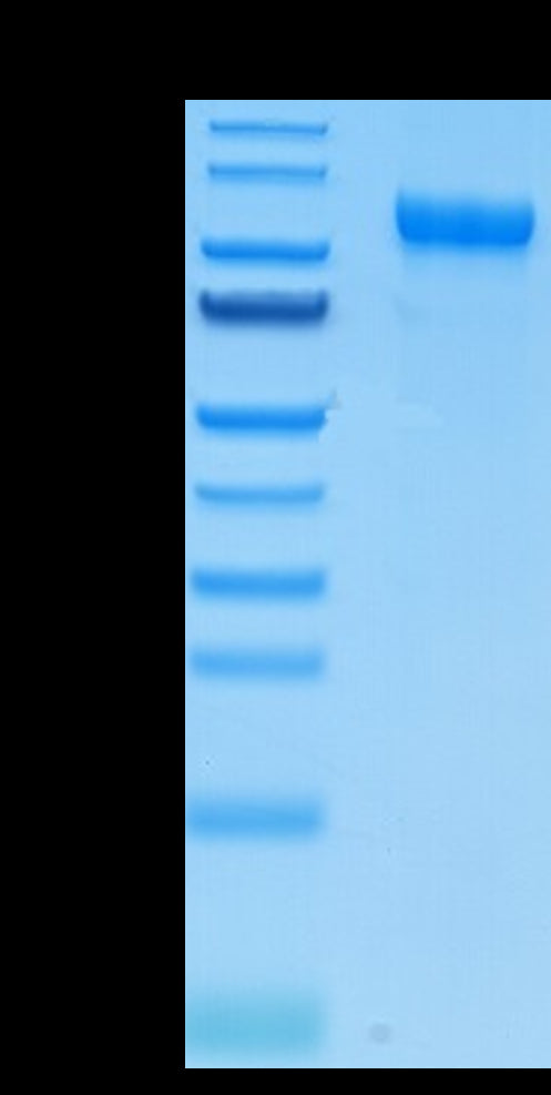 Mouse CDCP1 on Tris-Bis PAGE under reduced condition. The purity is greater than 95%.Recombinant Mouse CDCP1 Protein