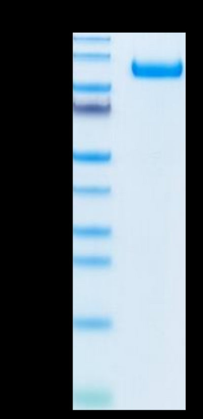 Biotinylated Rhesus macaque CDCP1 on Tris-Bis PAGE under reduced condition. The purity is greater than 95%.Biotinylated Rhesus macaque CDCP1 Protein, Active