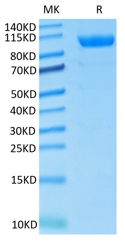 Rhesus macaque CDCP1 on Tris-Bis PAGE under reduced condition. The purity is greater than 95%..Recombinant Rhesus macaque CDCP1 Protein, Active
