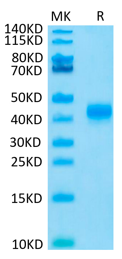 Human CD23 on Tris-Bis PAGE under reduced condition. The purity is greater than 95%.Recombinant Human CD23/Fc epsilon RII Protein