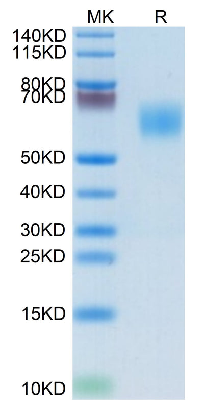 Biotinylated Human MICA on Tris-Bis PAGE under reduced condition. The purity is greater than 95%.Biotinylated Human MICA Protein, Active