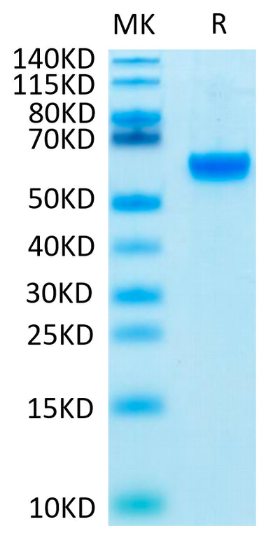 Biotinylated Human ROR2 on Tris-Bis PAGE under reduced condition. The purity is greater than 95%.Biotinylated Human ROR2/NTRKR2 Protein, Active