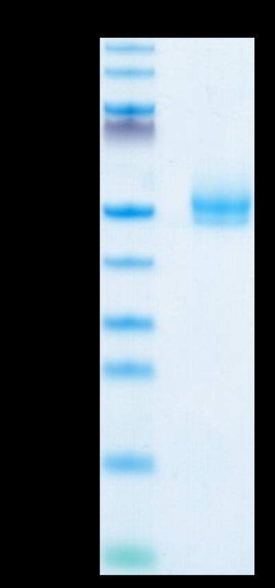 Human TGFBR1 on Tris-Bis PAGE under reduced condition. The purity is greater than 95%.Recombinant Human TGFBR1 Protein, Active
