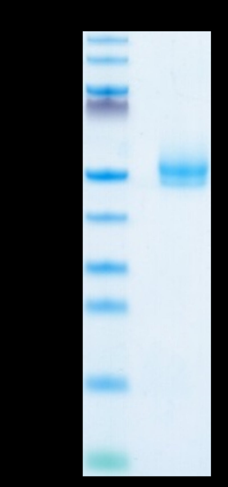 Human TGFBR1 on Tris-Bis PAGE under reduced condition. The purity is greater than 95%.Recombinant Human TGFBR1 Protein, Active