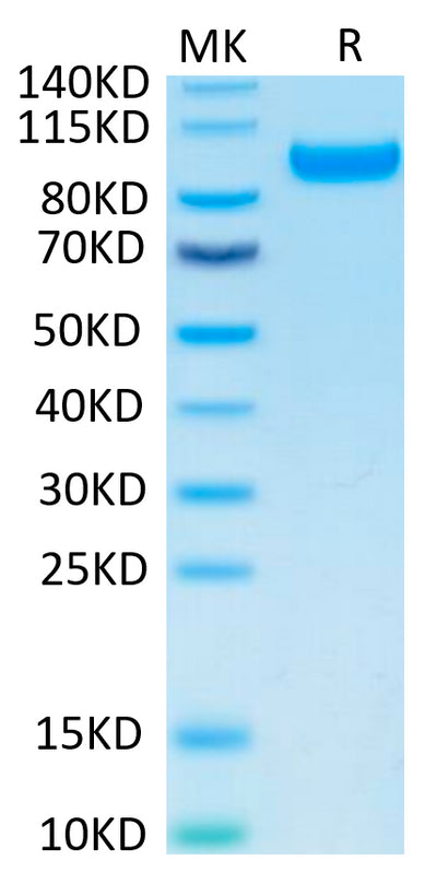 Human CDCP1 on Tris-Bis PAGE under reduced condition. The purity is greater than 95%.Recombinant Human CDCP1 Protein, Active