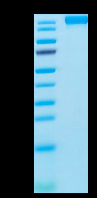 Human VEGF R2 on Tris-Bis PAGE under reduced condition. The purity is greater than 95%.Recombinant Human VEGF R2/KDR Protein, Active