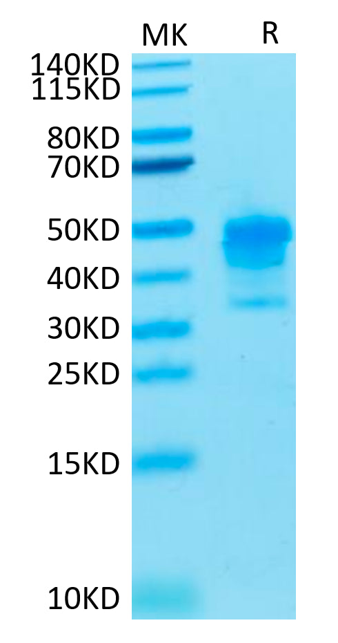 Cynomolgus MSLN on Tris-Bis PAGE under reduced condition. The purity is greater than 95%.Recombinant Cynomolgus MSLN/Mesothelin Protein, Active
