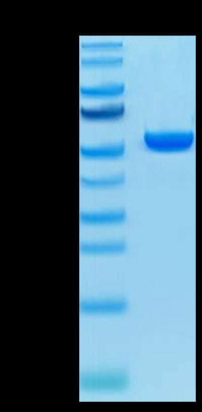 Human HLA-A*02:01&B2M&MAGE-A4 (GVYDGREHTV) Monomer on Tris-Bis PAGE under reduced condition. The purity is greater than 95%.Recombinant Human HLA-A*02:01&B2M&MAGE-A4 (GVYDGREHTV) Monomer Protein, Active