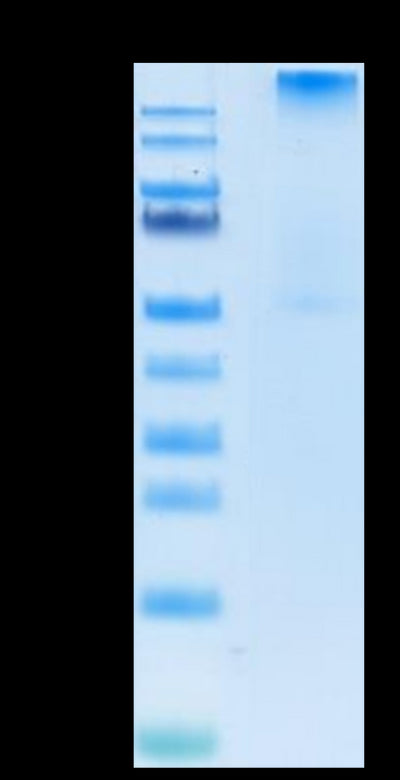 Human HLA-A*02:01&B2M&WT-1 (RMFPNAPYL) Tetramer on Tris-Bis PAGE under Non reducing (N) condition. The purity is greater than 95%.Recombinant Human HLA-A*02:01&B2M&WT-1 (RMFPNAPYL) Tetramer Protein, Active