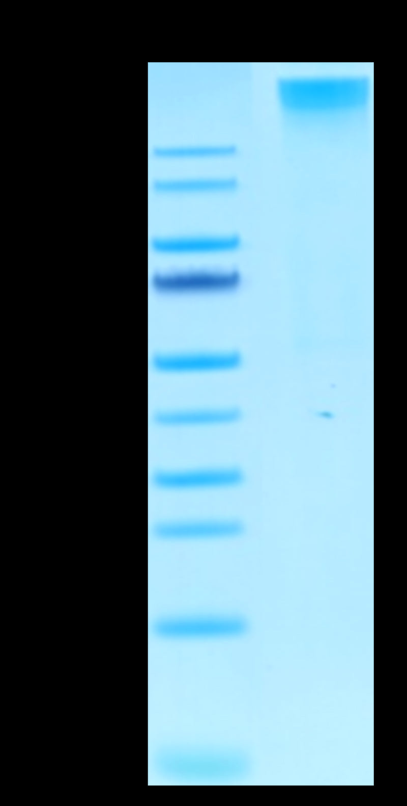 Human HLA-A*02:01&B2M&LMP2 (CLGGLLTMV) Tetramer on Tris-Bis PAGE under Non reducing (N) condition. The purity is greater than 95%.Recombinant Human HLA-A*02:01&B2M&LMP2 (CLGGLLTMV) Tetramer Protein, Active