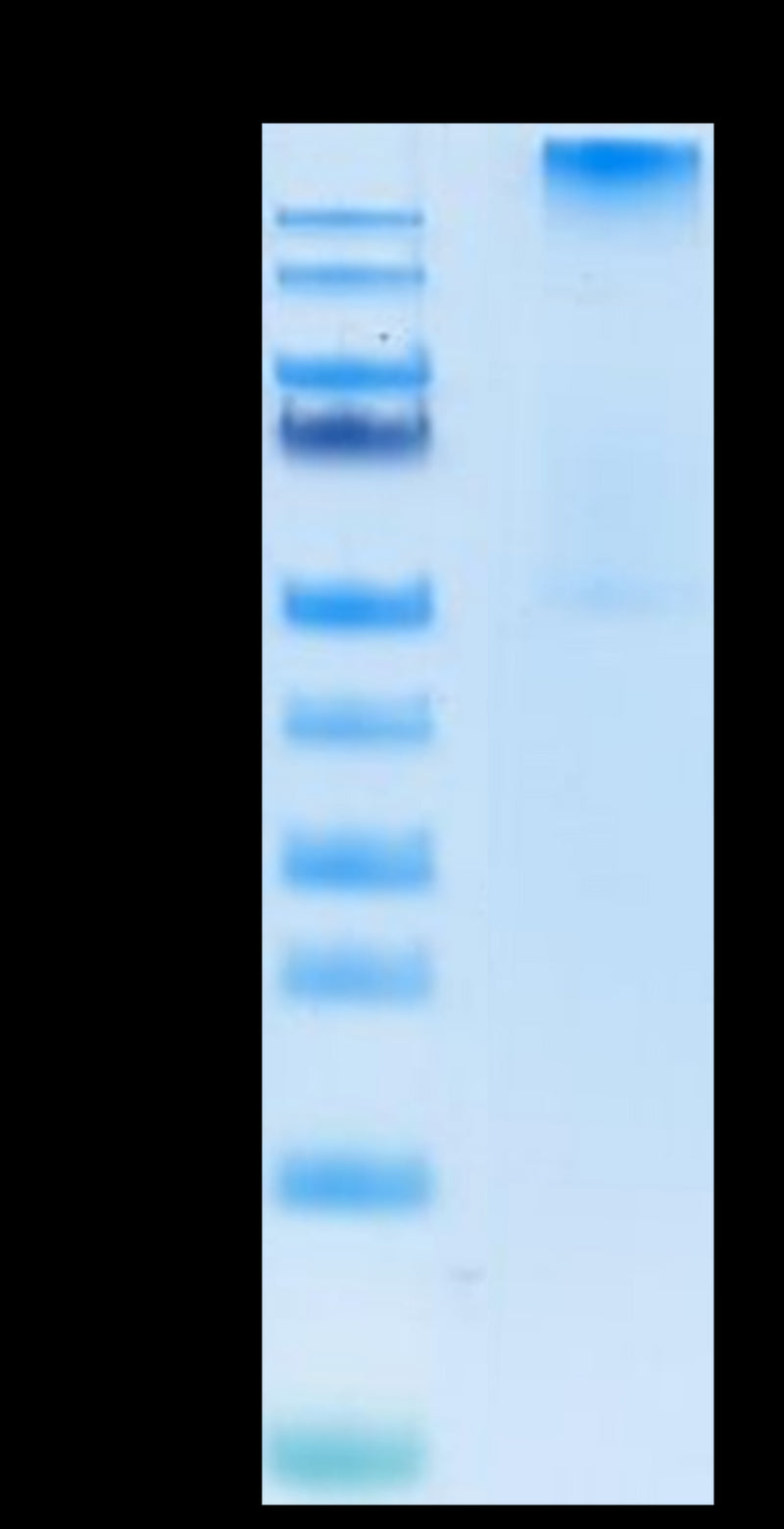 Human HLA-A*02:01&B2M&WT-1 (RMFPNAPYL) Tetramer on Tris-Bis PAGE under Non reducing (N) condition. The purity is greater than 95%.Recombinant Human HLA-A*02:01&B2M&WT-1 (RMFPNAPYL) Tetramer Protein, Active