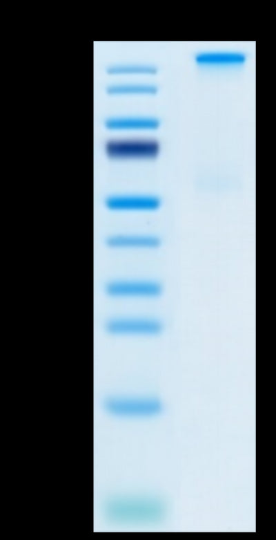 Chimeric HLA-A*02:01 (mα3) &B2M&LMP2 (CLGGLLTMV) Tetramer on Tris-Bis PAGE under Non reducing (N) condition. The purity is greater than 95%.Recombinant Chimeric HLA-A*02:01 (mα3) &B2M&LMP2 (CLGGLLTMV) Tetramer Protein, Active