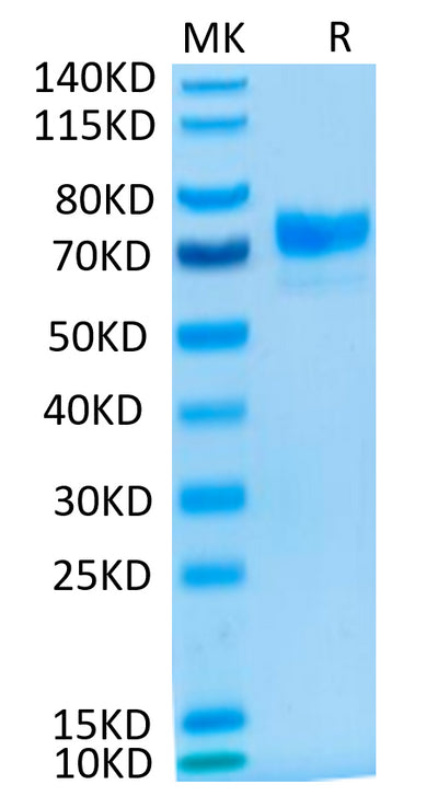 Cynomolgus MSLN on Tris-Bis PAGE under reduced condition. The purity is greater than 95%.Recombinant Cynomolgus MSLN/Mesothelin Protein, Active