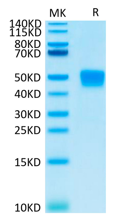 Mouse MSLN on Tris-Bis PAGE under reduced condition. The purity is greater than 95%.Recombinant Mouse MSLN/Mesothelin Protein, Active