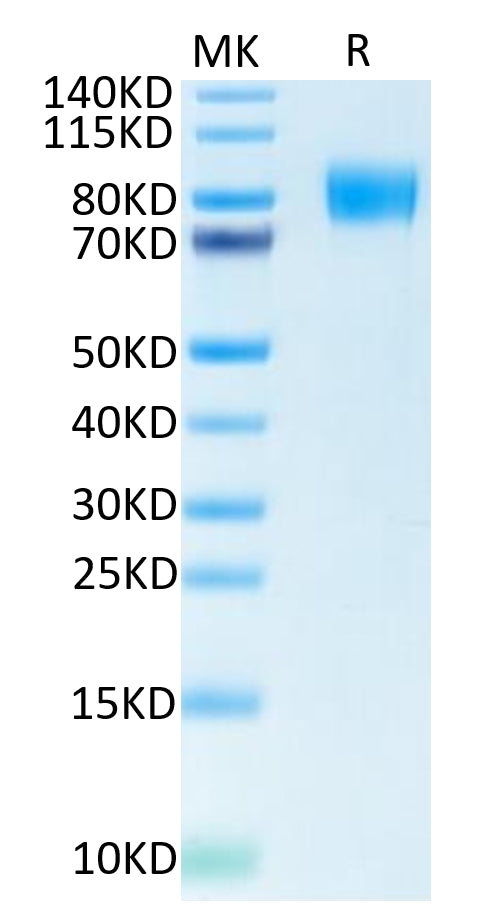 Biotinylated Human M-CSF R on Tris-Bis PAGE under reduced condition. The purity is greater than 95%.Biotinylated Human M-CSF R/CSF1R/CD115 Protein, Active