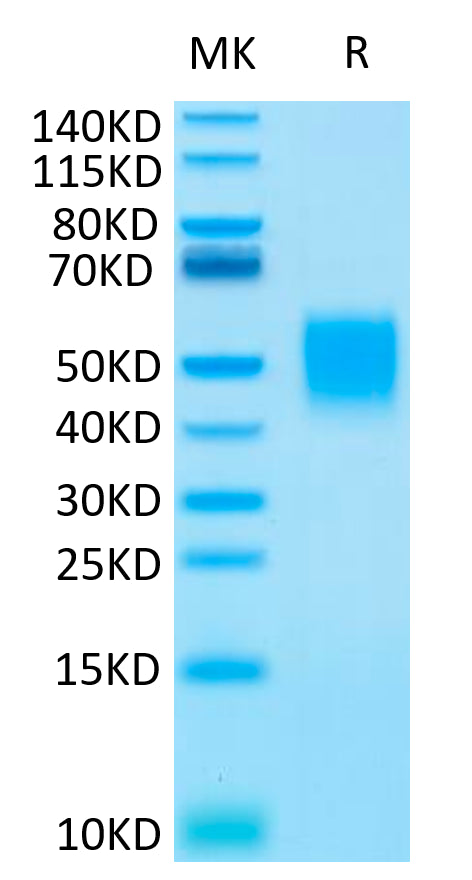Human CD89 on Tris-Bis PAGE under reduced condition. The purity is greater than 95%.Recombinant Human CD89 Protein