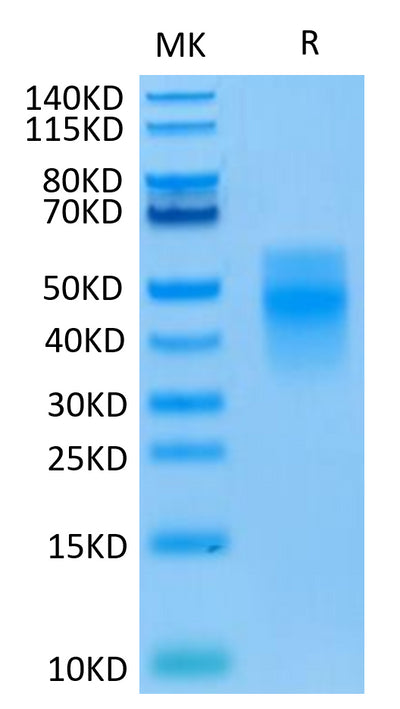 Human TREM1 on Tris-Bis PAGE under reduced condition. The purity is greater than 95%.Recombinant Human TREM1 Protein, Active