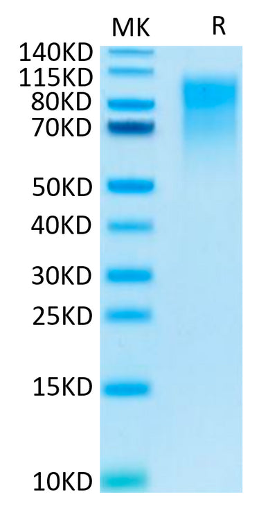 Human CEACAM-1 on Tris-Bis PAGE under reduced condition. The purity is greater than 95%.Recombinant Human CEACAM-1/CD66a Protein, Active