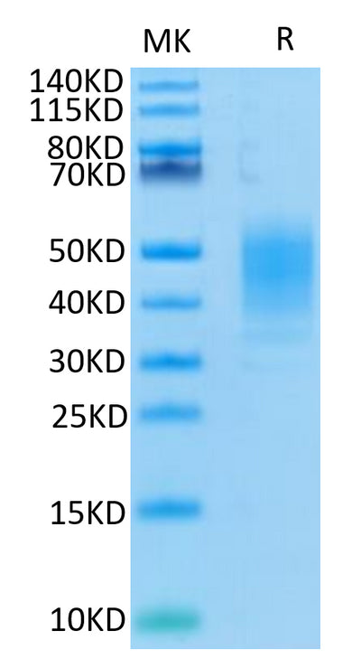 Human CLEC12A on Tris-Bis PAGE under reduced condition. The purity is greater than 95%.Recombinant Human CLEC12A/MICL/CLL-1 Protein, Active