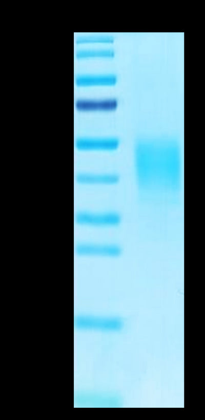 Biotinylated Human CLEC12A on Tris-Bis PAGE under reduced condition. The purity is greater than 95%.Biotinylated Human CLEC12A/MICL/CLL-1 Protein, Active