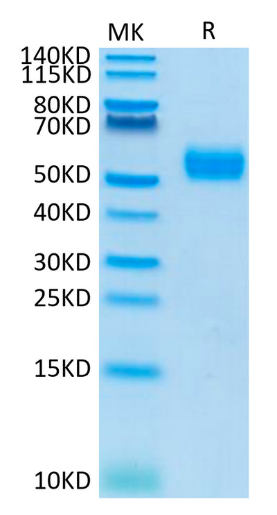Human SIRP alpha V4 on Tris-Bis PAGE under reduced condition. The purity is greater than 95%.Recombinant Human SIRP alpha V4 Protein, Active